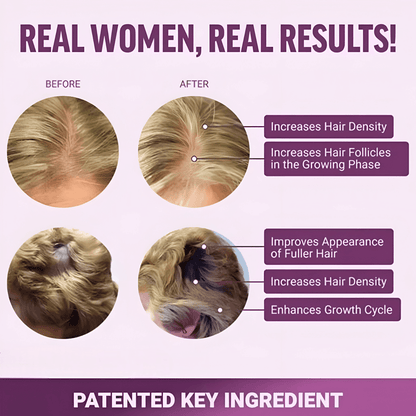 Hair Growth Accelerator Soft Chews™